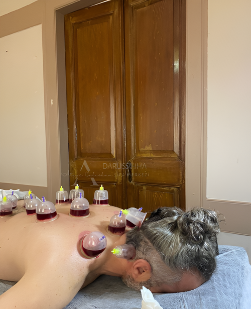 hijama